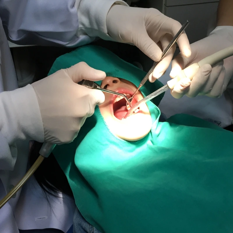 Tim tokom pažljivo pripremljenog oralnohirurškog zahvata